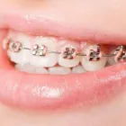 Yrityksen 2 kuva HAMMASLÄÄKÄRI TIINA YRJÖ-KOSKINEN OY Hammaslääkäripalvelut  Riihimäki 06