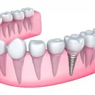 Yrityksen 1 kuva HAMMASLÄÄKÄRIKESKUS JOUHEVA  Ylivieska 14