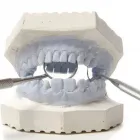 Yrityksen 3 kuva HAMMASLABORATORIO MARKKU JÄRVINEN Laboratoriotutkimukset  Tampere 11