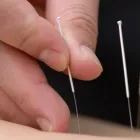 Yrityksen 2 kuva REPORANKA OSTEOPAATTI JARMO KYLLÖNEN Muu terveyspalvelu  Oulu 14