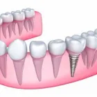 Yrityksen 1 kuva SATUHAMMAS OY Hammaslääkäripalvelut  Vantaa 18