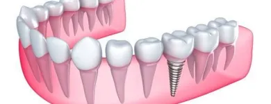 Yrityksen 1 kuva HAMMASLÄÄKÄRIKESKUS JOUHEVA  Ylivieska 14